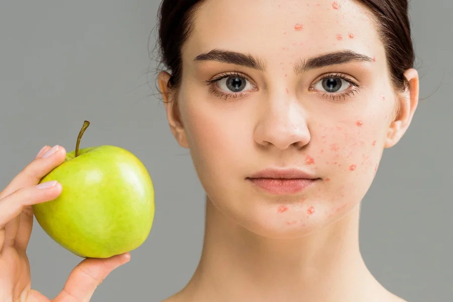 Skin Health